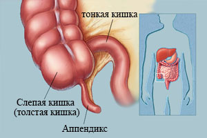симптомы очищения организма симптомы очищения организма